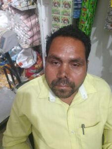 घरेलू विवाद बना खूनी संघर्ष: चचेरे जीजा ने युवक पर किया हमला, दांत से काटी नाक